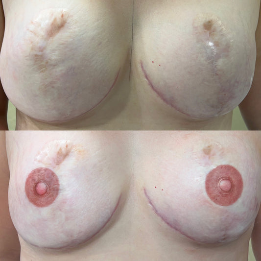 3D Areola Training Registration only (April 12-14, 2024) read details for class information